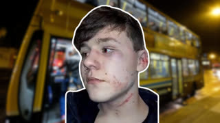 Diversity is our Strength! Irish Boy Almost beaten to Death! Reaction!